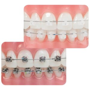 Clínica Dental Manuel Marín - Ortodoncia