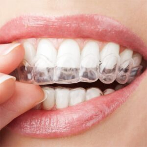 Clínica Dental Manuel Marín - Ortodoncia
