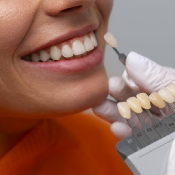 Clínica Dental Manuel Marín - Prótesis fijas