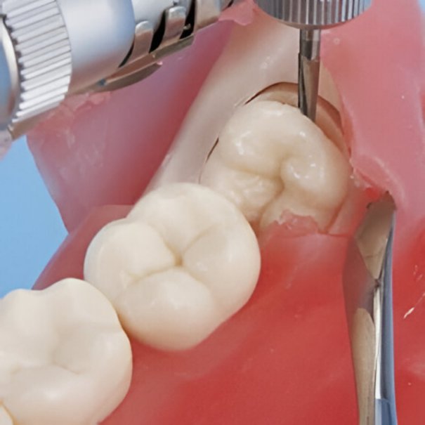 Clínica Dental Manuel Marín - Cirugía