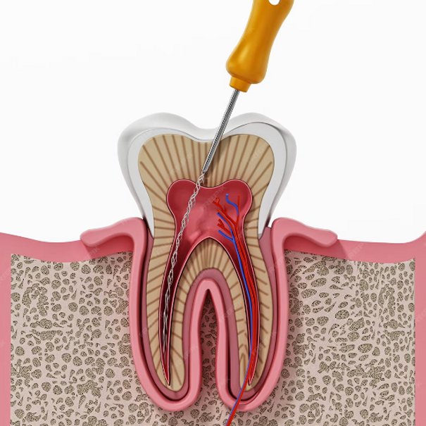 Clínica Dental Manuel Marín - Endodoncia