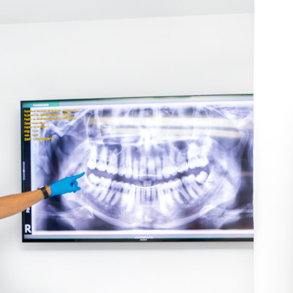 Clínica Dental Manuel Marín - Radiología Dental